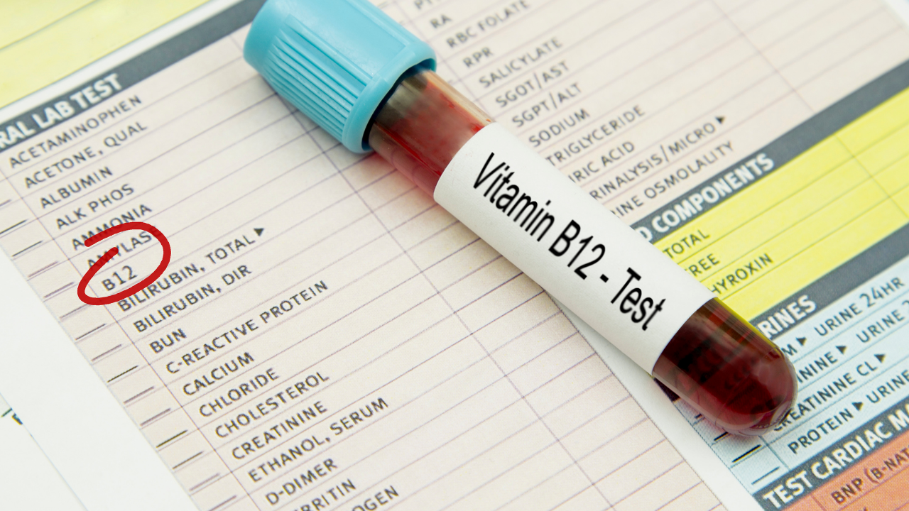test tube of a vitamin b12 test
