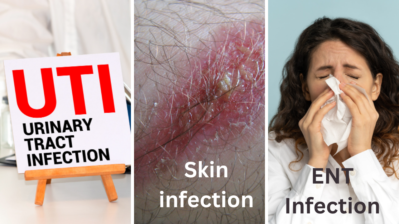 collage of different infections 