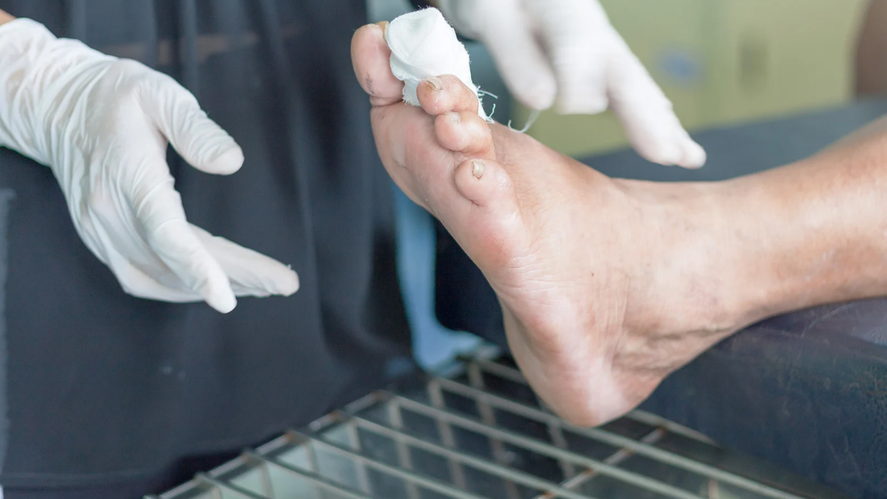 neuropathic pain with injured toe