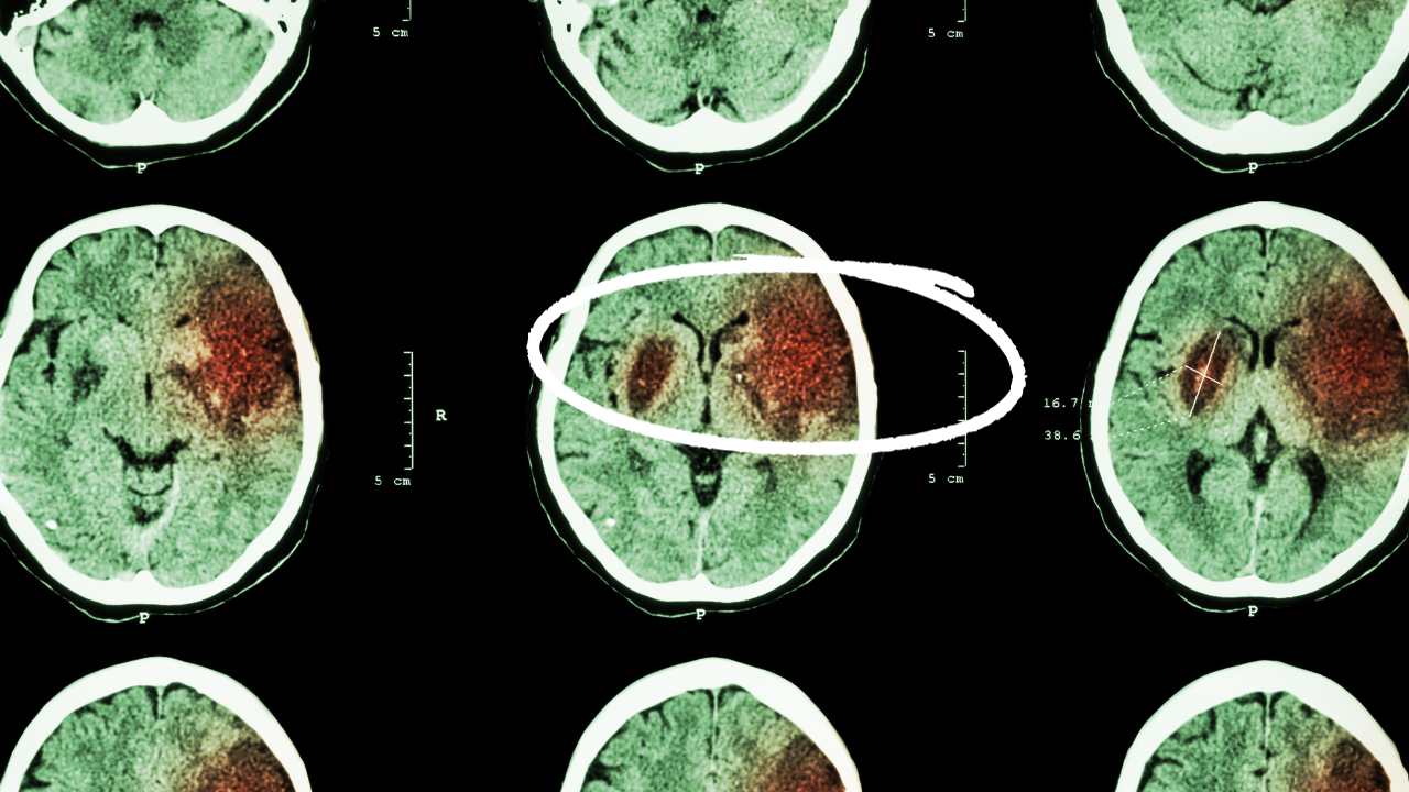 stroke imaging with visible stroke