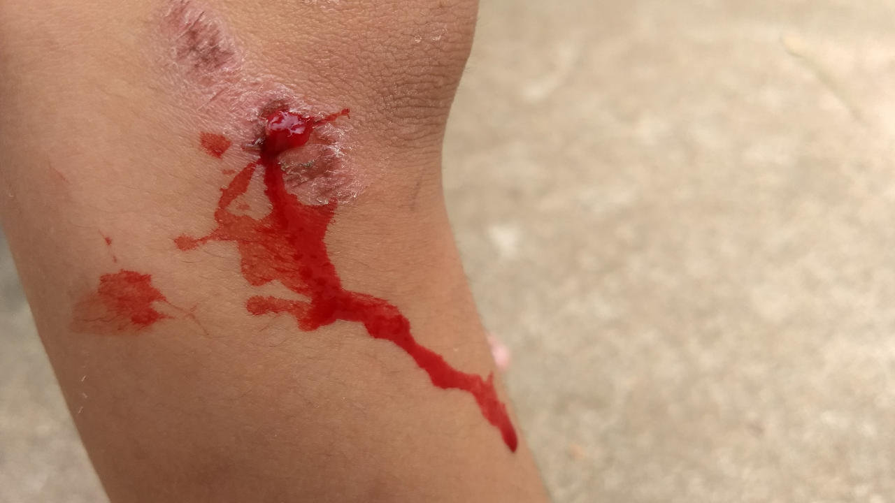 body part with blood